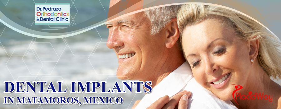 Dental Implants in Matamoros, Mexico